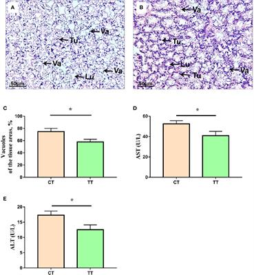 Comparative Proteomic Analysis Revealed the Mechanism of Tea Tree Oil Targeting Lipid Metabolism and Antioxidant System to Protect Hepatopancreatic Health in Macrobrachium rosenbergii